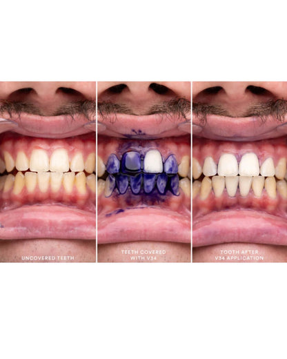 HiSmile V34 Crema Blanqueadora