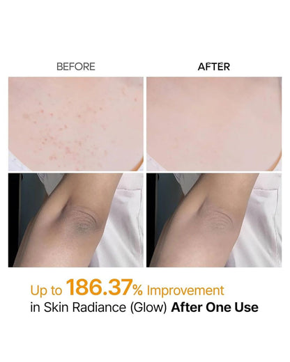 DR MELAXIN Spray Corporal Peel Shot